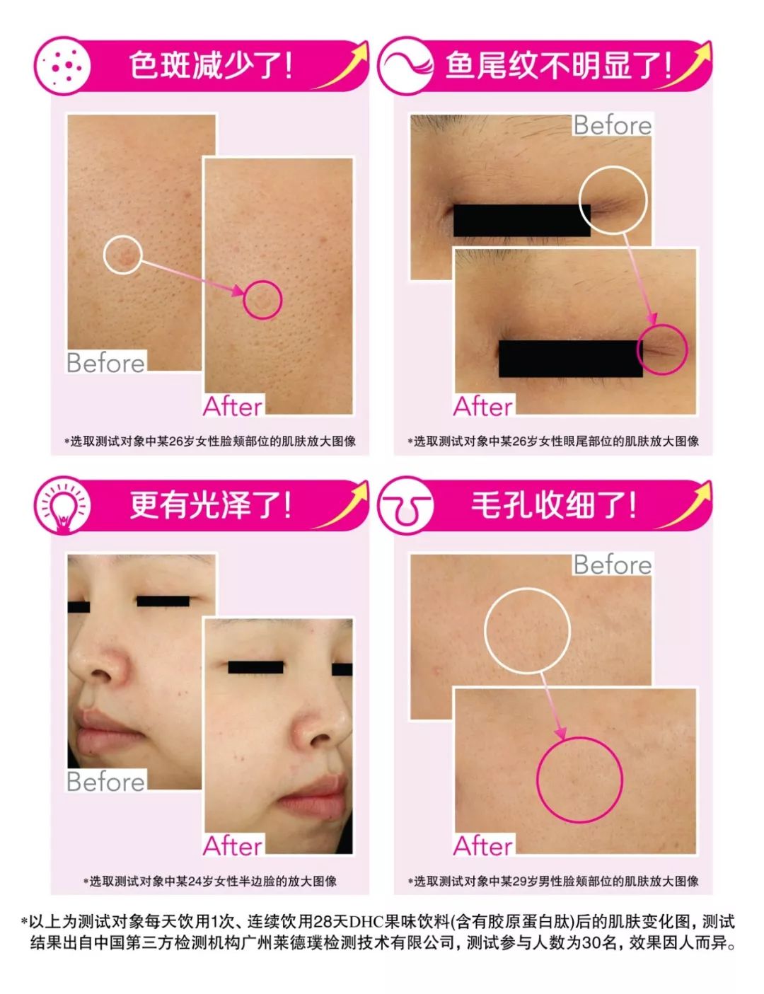 胶原蛋白埋线如何操作,胶原蛋白埋线真的有用吗