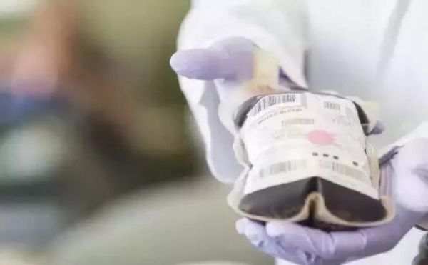 “关艾”①丨艾滋病,不是你想象的那样