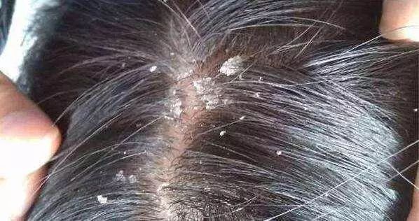 这个拯救颜值的科技产品，居然是一次错误的实验结果？