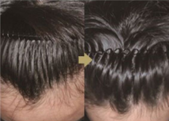 这个拯救颜值的科技产品，居然是一次错误的实验结果？