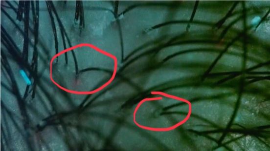 这个拯救颜值的科技产品，居然是一次错误的实验结果？