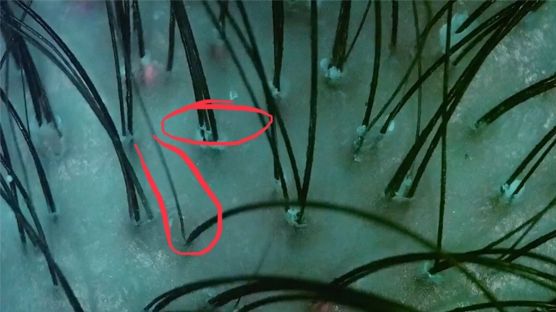 这个拯救颜值的科技产品，居然是一次错误的实验结果？