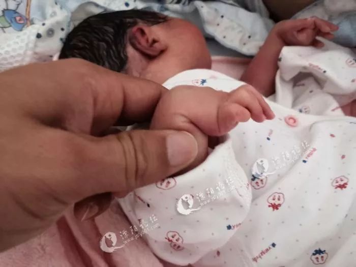 婴儿手脚畸形没查出来,新生儿手指畸形产检医院有责任么