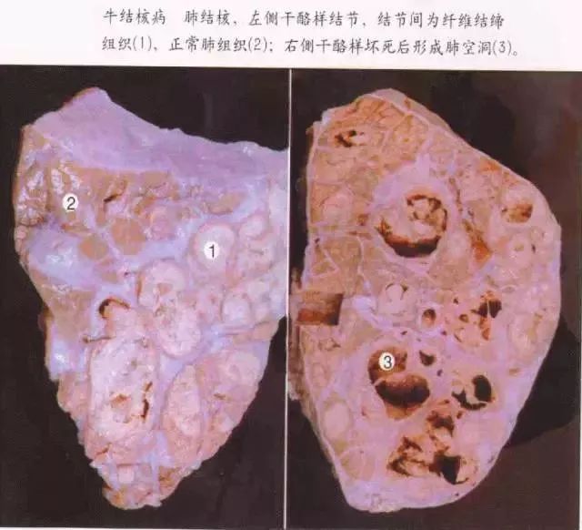 吸毒容易感染艾滋病的原因,吸毒传染艾滋病的风险不高