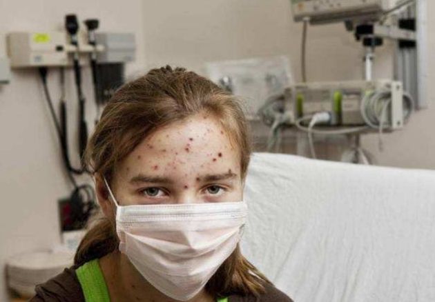 吸毒容易感染艾滋病的原因,吸毒传染艾滋病的风险不高