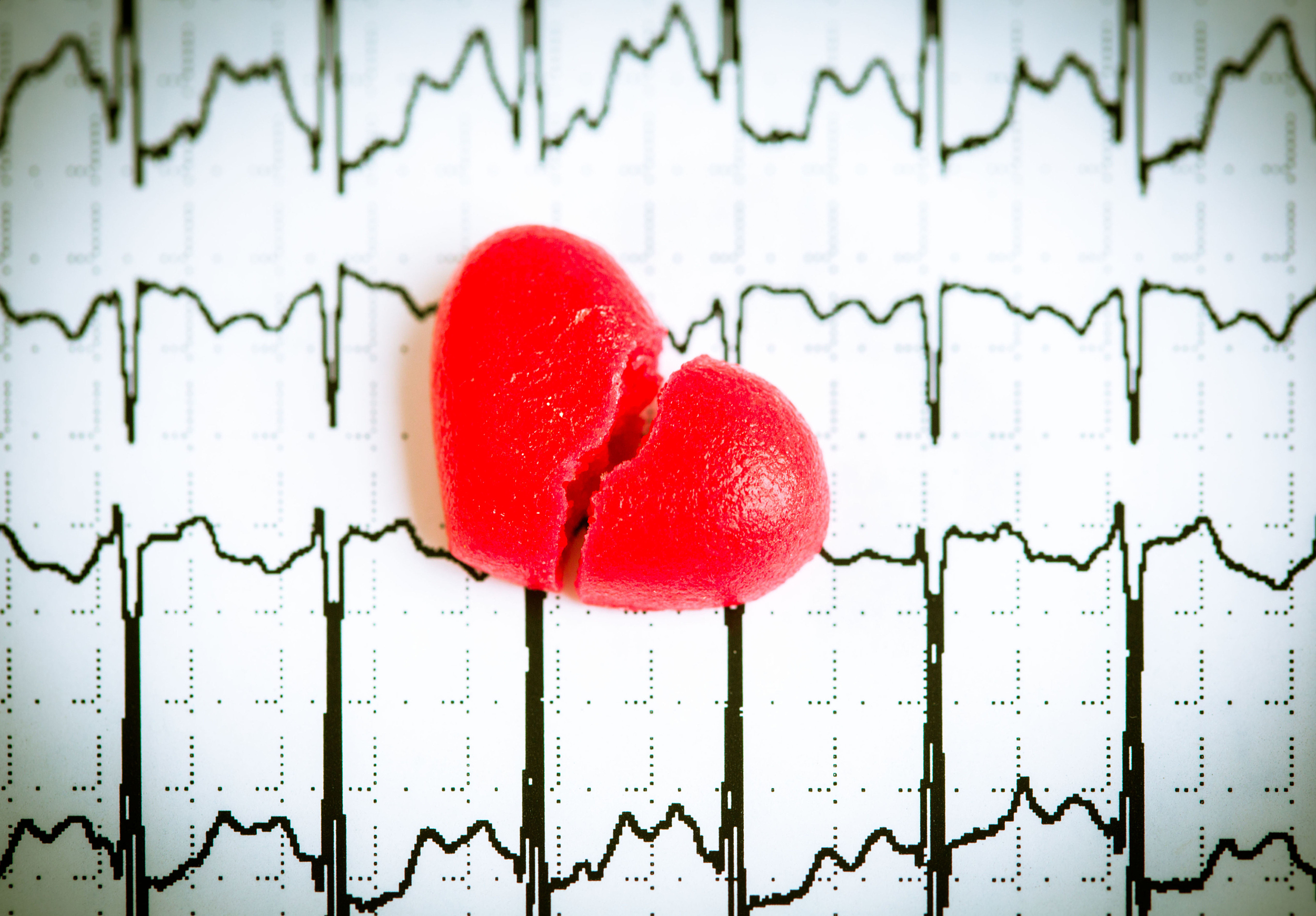 猝死前的10个救命信号是什么,要警惕这些猝死高危信号