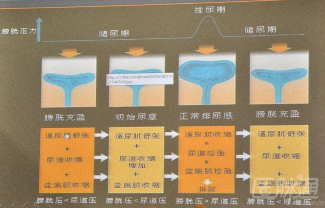 张弛教授：糖尿病神经源性膀胱诊治新进展|CDS2019