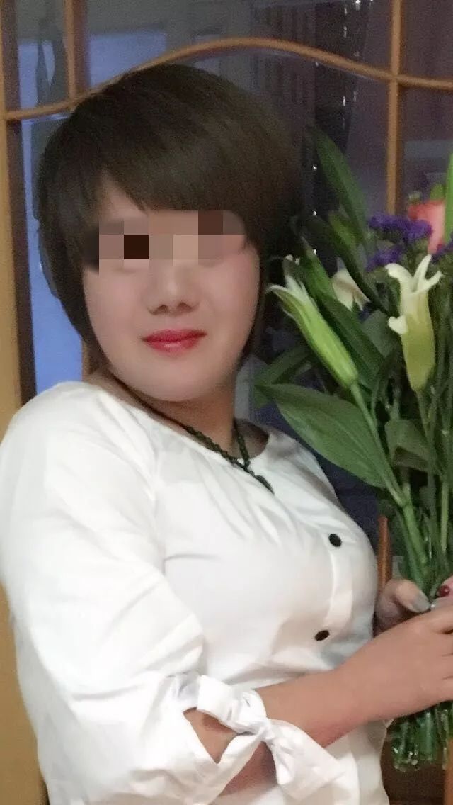 女性隆鼻变成三毛鼻,南京女子整容成猪鼻子