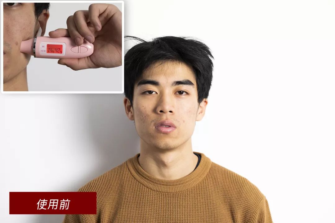 男士脸爆皮用什么保湿,男生秋冬脸上起皮用什么保湿