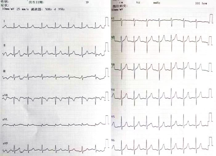 甯歌鐨勫績鍐呯鍏稿瀷鐥呬緥,蹇冨唴绉戠殑鍏稿瀷鐥呬緥