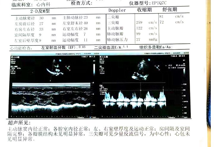 甯歌鐨勫績鍐呯鍏稿瀷鐥呬緥,蹇冨唴绉戠殑鍏稿瀷鐥呬緥