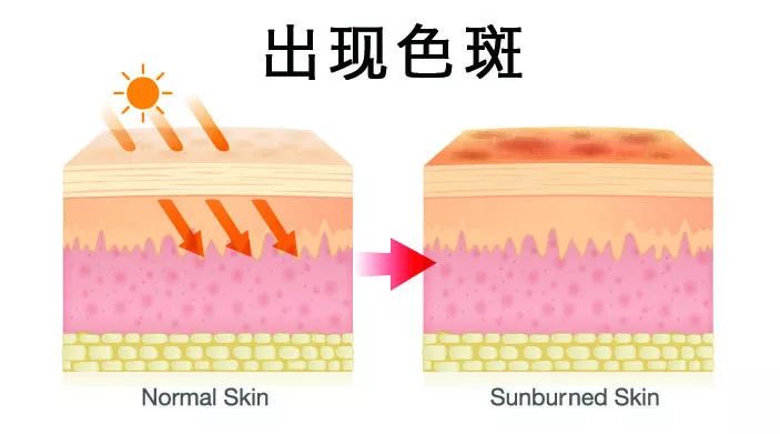 有没有什么方法变白一点,真正有效变白的护肤品