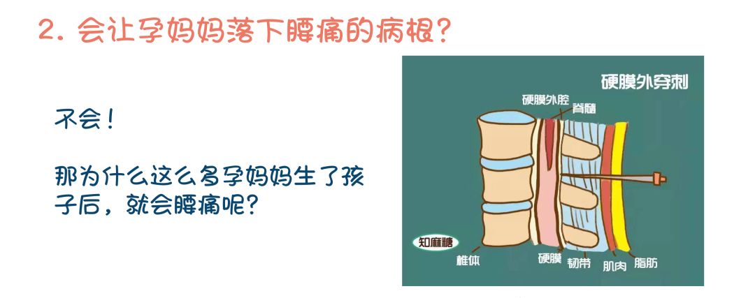 无痛舒适--给孕妈妈最好的礼物