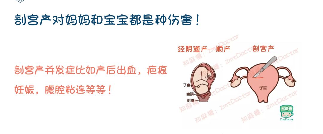 无痛舒适--给孕妈妈最好的礼物