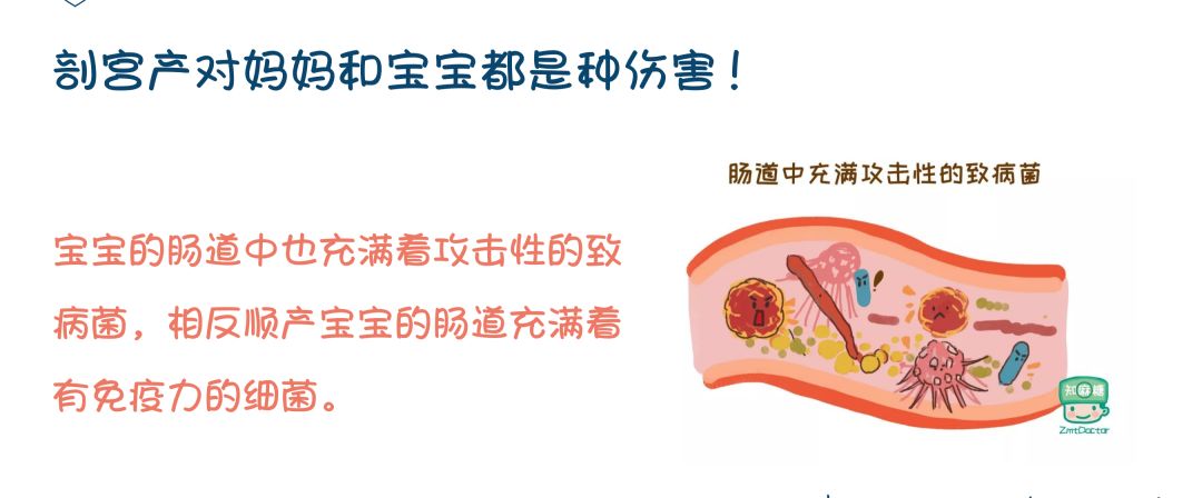 无痛舒适--给孕妈妈最好的礼物