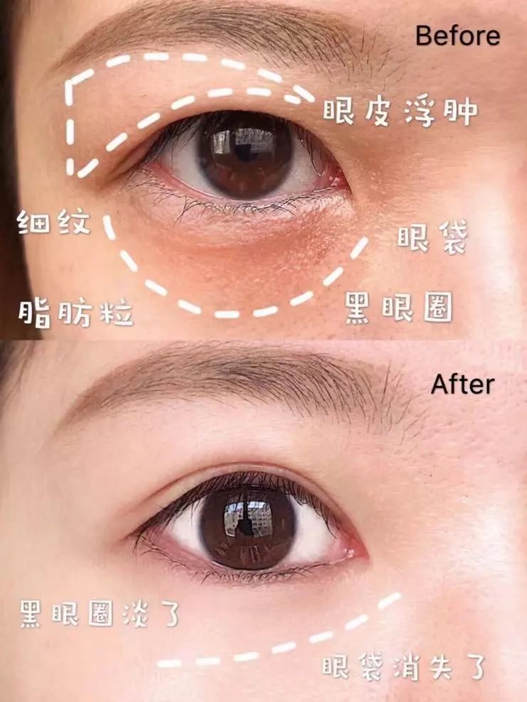 眼部周围除皱霜,眼部抗皱紧致面霜