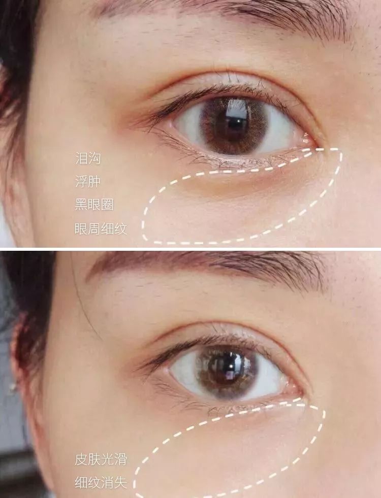 眼部周围除皱霜,眼部抗皱紧致面霜