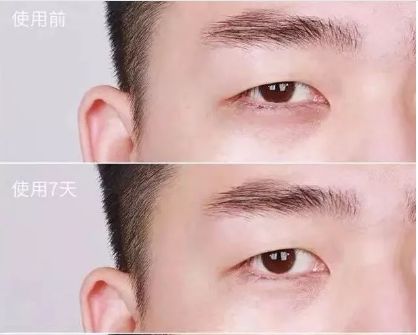 眼部周围除皱霜,眼部抗皱紧致面霜