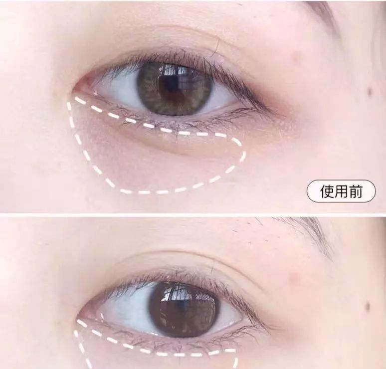 眼部周围除皱霜,眼部抗皱紧致面霜