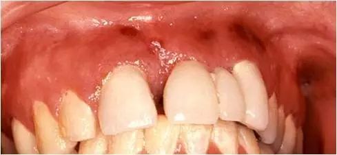 慧眼识“艾”情，让您见识牙医的“另一面”