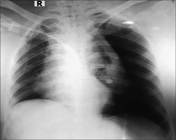 致命胸痛的10个常见部位,致命性胸痛的常见病因有哪些