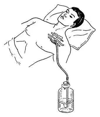 致命胸痛的10个常见部位,致命性胸痛的常见病因有哪些