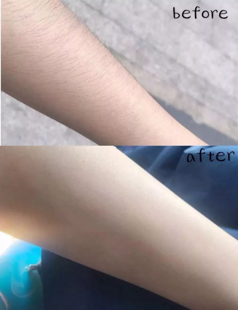 脱毛轻轻松松告别夏日尴尬,脱毛最好的季节