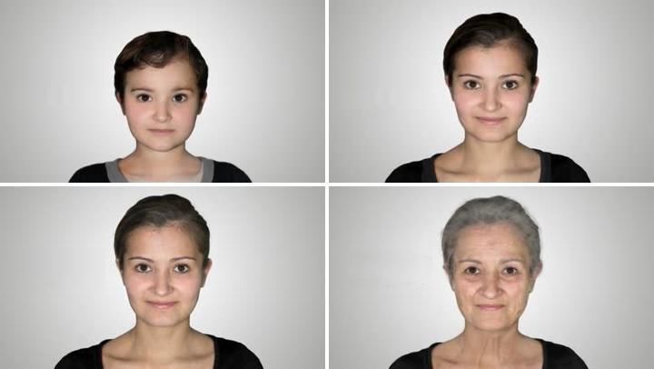 热玛吉抗衰老手术适应6类人群,了解热玛吉抗衰老看这篇就够了