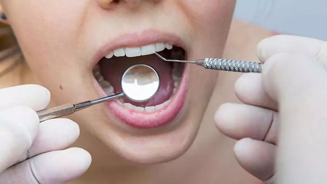 益生菌含片有什么作用,益生菌漱口含片