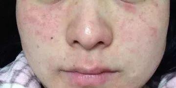 洗脸仪会对皮肤有伤害吗,洗脸仪真的假的