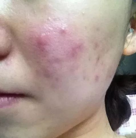 洗脸仪会对皮肤有伤害吗,洗脸仪真的假的