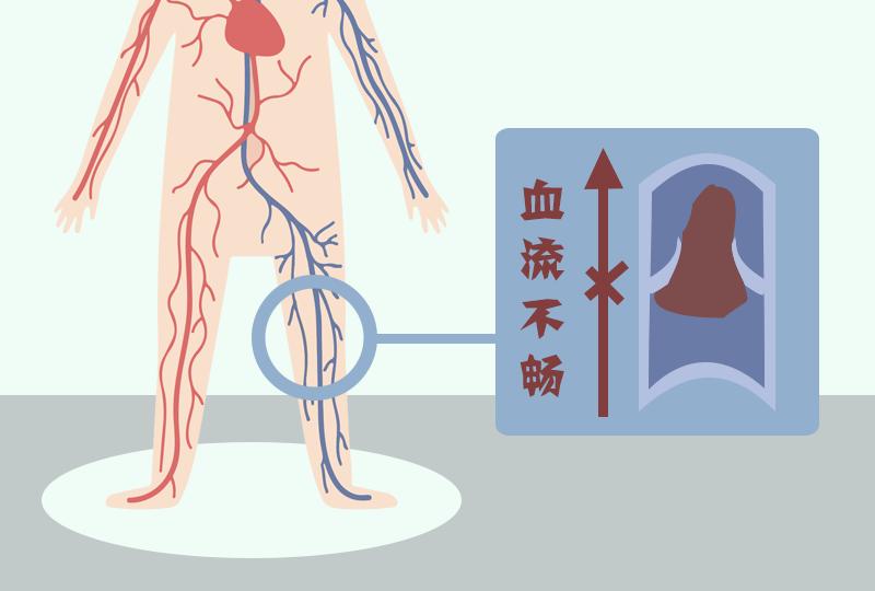 辟谣特工队|坚果是天然“血管清道夫”?言过其实了