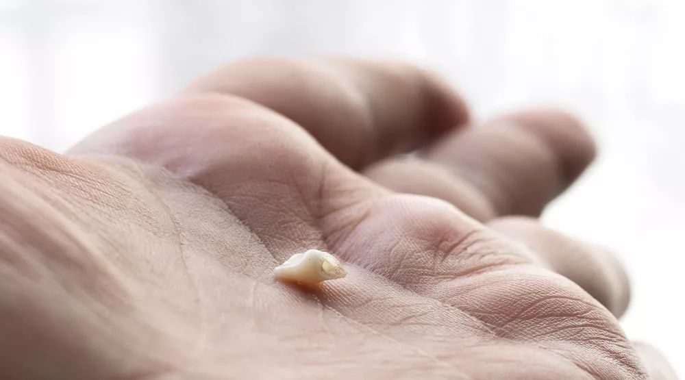 口腔疾病是最普遍的健康问题,牙齿疾病占口腔疾病的比例是多少