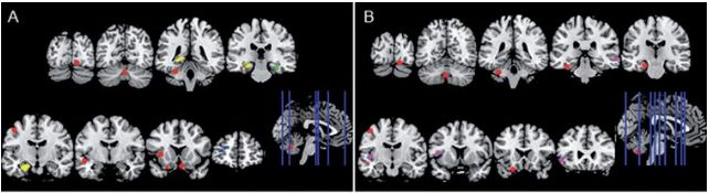 假性阿尔茨海默,假装高情商的人心理