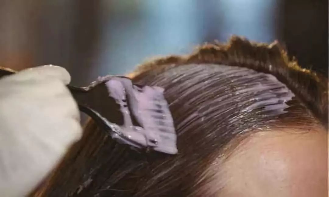 眼睛肿成缝，头皮溃烂…一周接诊20多例！年前干这事的荆门人要注意了