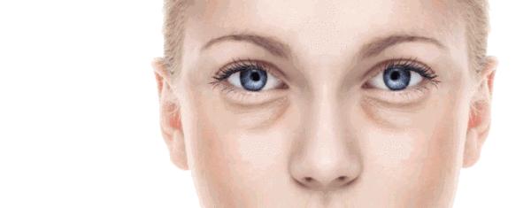 眼霜对眼袋有用吗别再被忽悠了,眼袋涂眼霜有用吗