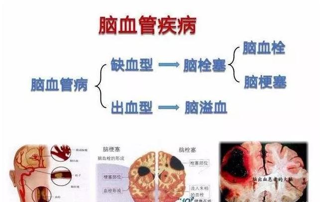 天冷老人血压突然升高到190怎办,高温天气冠心病人血压升高