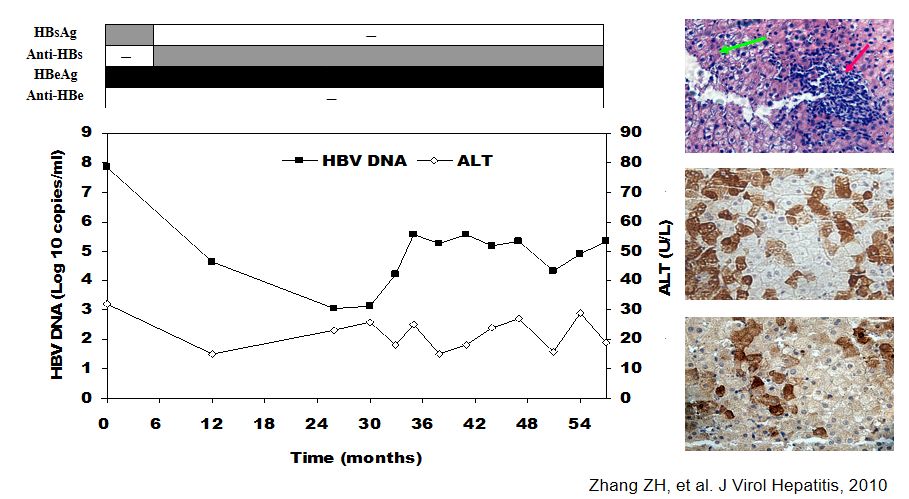 hbsag阴性是没有抗体吗,hbsag阴性还用做肝功吗