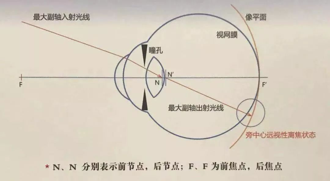 近视防控的最有效的三大方法,近视防控的常用方法与最新进展