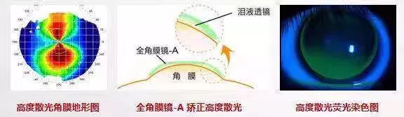 近视防控的最有效的三大方法,近视防控的常用方法与最新进展