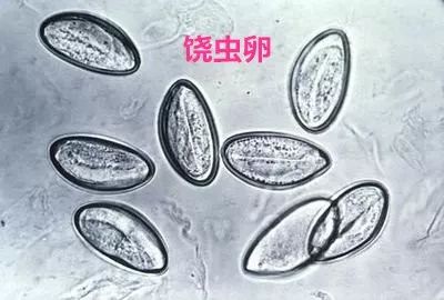 肛门痒有蛲虫子用什么药,小孩屁股痒有蛲虫怎么止痒