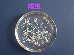 肛门痒有蛲虫子用什么药,小孩屁股痒有蛲虫怎么止痒