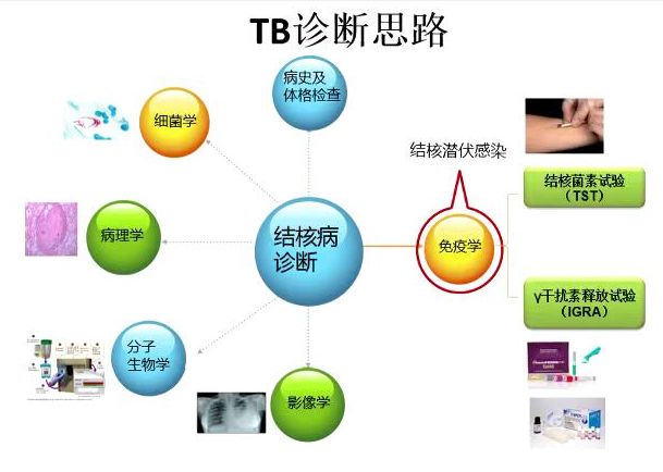 卢水华教授：结核病实验室诊断和药物治疗新进展