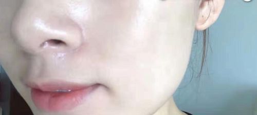 一招改善肩部疼痛,4个方法缓解肩周疼痛