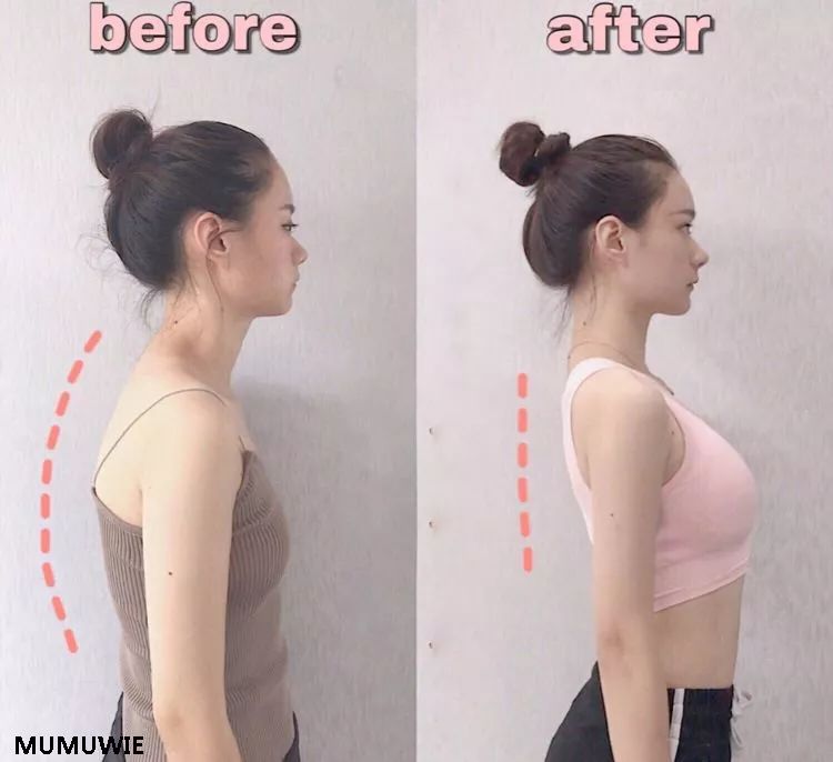 一招改善肩部疼痛,4个方法缓解肩周疼痛