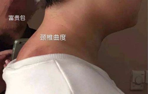 一招改善肩部疼痛,4个方法缓解肩周疼痛