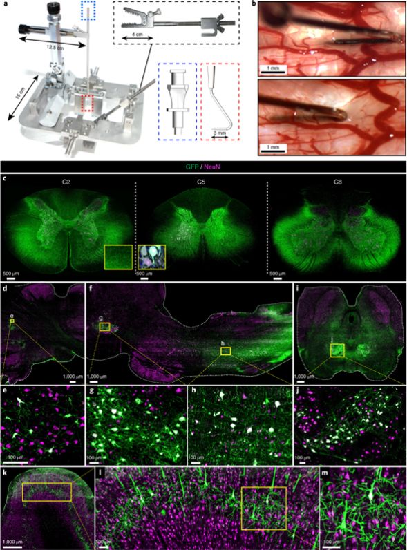 nature子刊癌症新突破,nature子刊人文社科