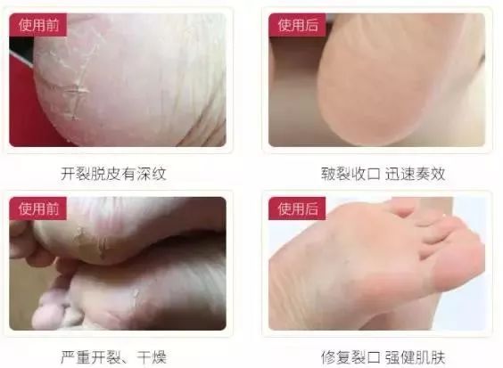 手部护理保养精油,spa护理手套