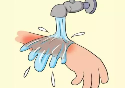 *花爆烟竹**炸伤如何急救？