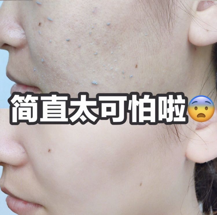 柔嫩抛光|脸上搓出3斤泥!难怪又黄又暗又黑头!10秒给脸蛋“剥壳”,厉害